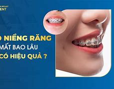 Trình Cục Mất Bao Lâu